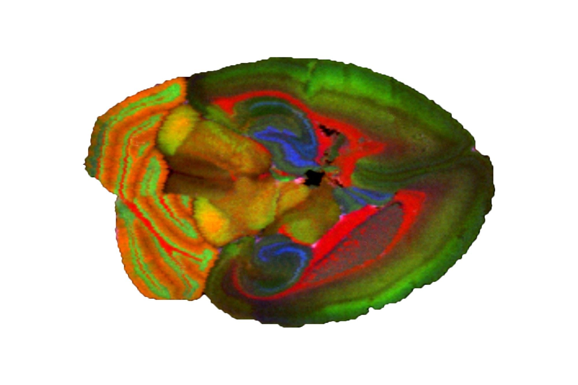 Mass Spectrometry Imaging | DESI and MALDI | Waters